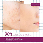 Siero Bava di Lumaca | Puro 90% (30 ml)