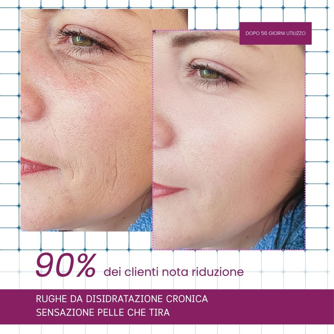 Siero Acido Ialuronico (30 ml)