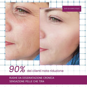 Siero Acido Ialuronico (30 ml)