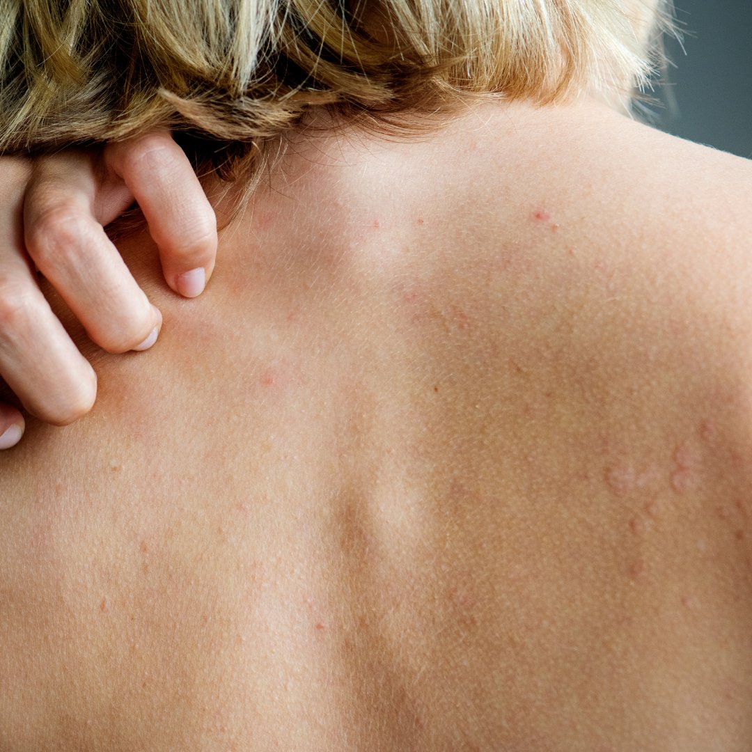 Crema Purificante Anti Età Corpo - Biolook